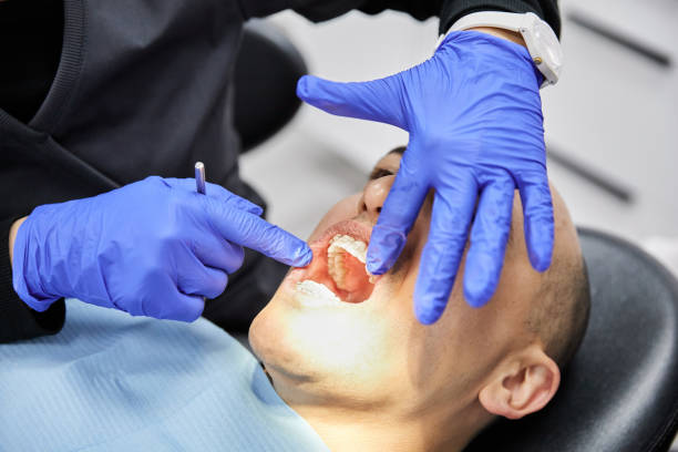 Best Emergency Wisdom Teeth Removal in Hale Center, TX