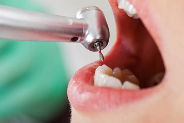 Best Walk-In Emergency Dentist in Hale Center, TX